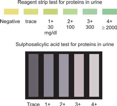 Proteinuria: Purpose, Test Procedure and Results.